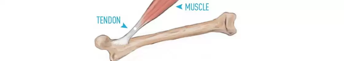 tendinite kine forest